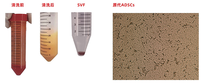 脂肪组织消化酶图.png